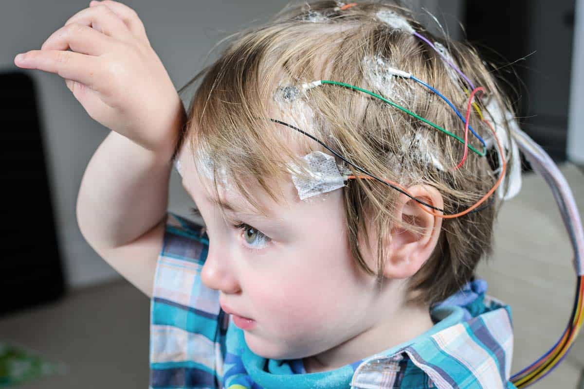 La terapia combinata THC/CBD riduce la frequenza delle crisi nei bambini con epilessia